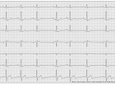 Evaluación cardiológica veterinaria